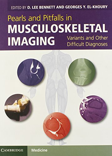 [PDF] Pearls and Pitfalls in Musculoskeletal Imaging: Variants and Other Difficult Diagnoses 1st Edition (2013) by D. Lee Bennett