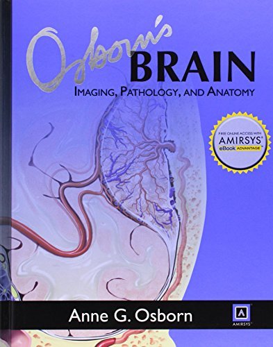 [PDF] Osborn’s Brain Imaging, Pathology, and Anatomy (2013) by Anne G. Osborn