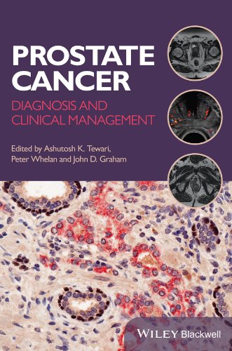 [PDF] Prostate Cancer: Diagnosis and Clinical Management 1st Edition (2014) by Ashutosh K. Tewari