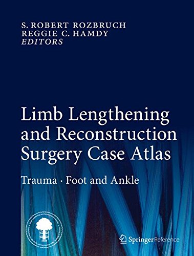 [PDF] Limb Lengthening and Reconstruction Surgery Case Atlas (2015) by S. Robert Rozbruch