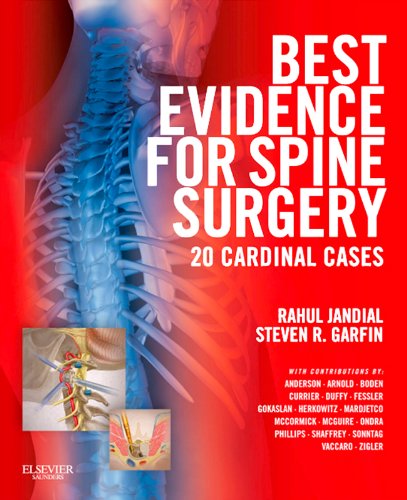 [PDF] Best Evidence for Spine Surgery-20 Cardinal Cases (Feb 16, 2012) (1437716253) ( ) (2012) by Rahul Jandial