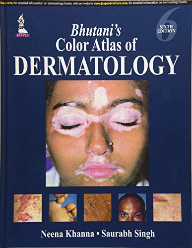 [PDF] Bhutani’s Color Atlas of Dermatology 6th Edition (2015) by Neena, M.D. Khanna