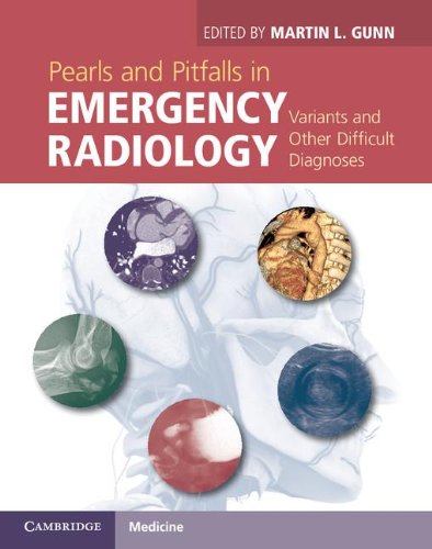 [PDF] Pearls and Pitfalls in Emergency Radiology (2013) by Martin L. Gunn