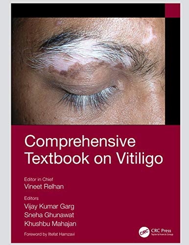 [PDF] Comprehensive Textbook on Vitiligo 1st Edition (2020) by Vineet Relhan