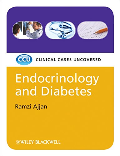 [PDF] Endocrinology and Diabetes, Clinical Cases Uncovered (2009) by Ramzi Ajjan