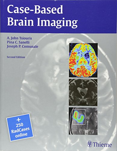 [PDF] Case-Based Brain Imaging, 2nd Edition (2013) by Associate Professor of Clinical Radiology, Weill Cornell Medical College, New York, NY, USA