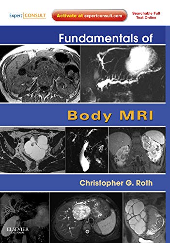 [PDF] Fundamentals of Body MRI 1st Edition (2012) by Christopher G. Roth MD