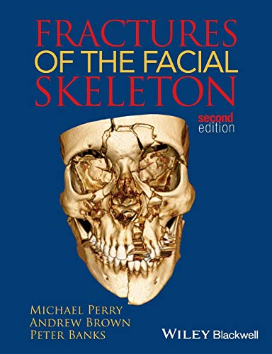 [PDF] Fractures of the Facial Skeleton 2nd Edition (2015) by Perry