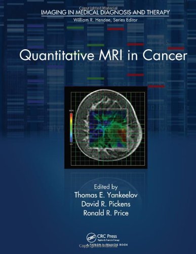 [PDF] Quantitative MRI in Cancer (2011) by Thomas E. Yankeelov