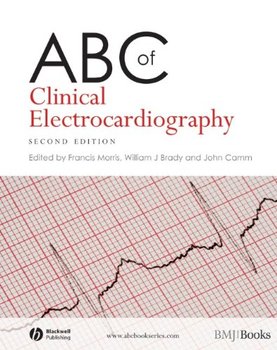 [PDF] ABC of Clinical Electrocardiography (2008) by Francis Morris