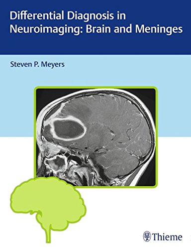 [PDF] Differential Diagnosis in Neuroimaging: Brain and Meninges (2016) by Steven Meyers