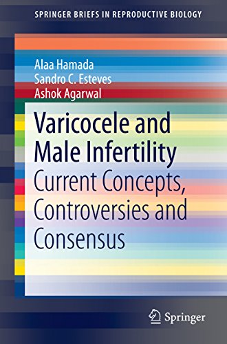 [PDF] Varicocele and Male Infertility Current Concepts, Controversies and Consensus (2016) by Alaa Hamada