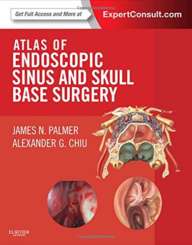 [PDF] Atlas of Endoscopic Sinus and Skull Base Surgery Expert Consult, 1st Edition (2013) by James N. Palmer MD and Alexander G. Chiu MD