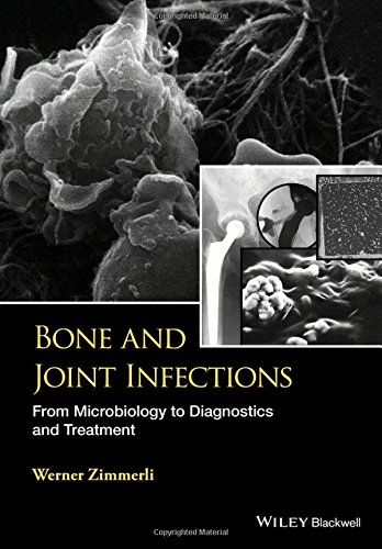 [PDF] Bone and Joint Infections: From Microbiology to Diagnostics and Treatment (2015) by W. Zimmerli