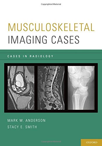 [PDF] Musculoskeletal Imaging Cases 1st Edition (2013) by Mark W. Anderson