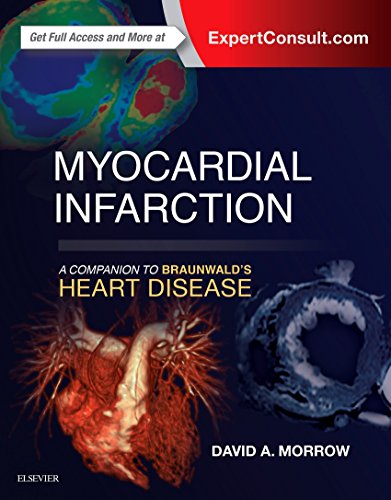 [PDF] Myocardial Infarction: A Companion to Braunwald’s Heart Disease 1st Edition (2017) by David A. Morrow