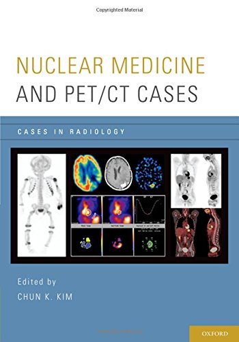 [PDF] Nuclear Medicine and PET/CT Cases 1st Edition (2016) by Chun K. Kim