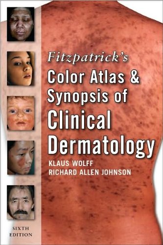 [PDF] Fitzpatrick’s Color Atlas and Synopsis of Clinical Dermatology 6th Edition (2009) by R. Johnson K. Wolff