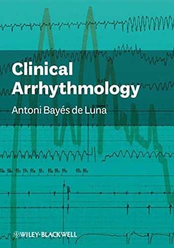 [PDF] Clinical Arrhythmology (2011) by Antoni BayÃ©s de Luna