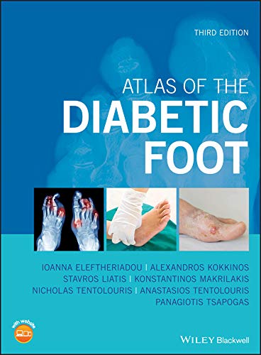 [PDF] Atlas of the Diabetic Foot 3rd Edition (2019) by Ioanna Eleftheriadou