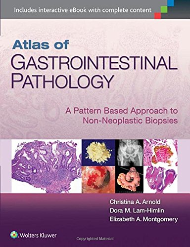 [Epub] Atlas of Gastrointestinal Pathology – A Pattern Based Approach to Non-Neoplastic Biopsies (2014) by Christina Arnold M.D. and Dora Lam-Himlin M.D