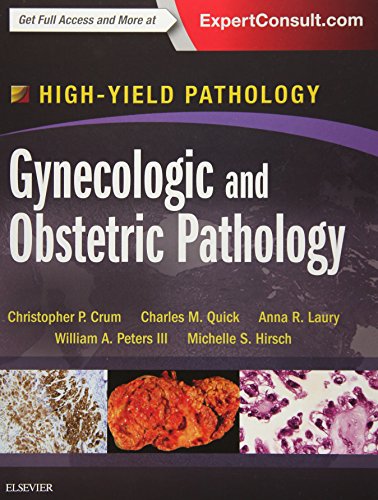 [PDF] Gynecologic and Obstetric Pathology: A Volume in the High Yield Pathology Series 1st Edition (2015) by Christopher P. Crum