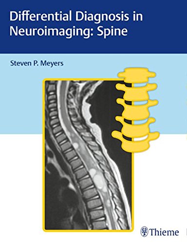 [PDF] Differential Diagnosis in Neuroimaging: Spine (2017) by Steven Meyers