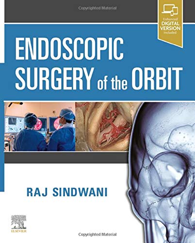 [PDF] Endoscopic Surgery of the Orbit 1st Edition (2020) by Raj Sindwani