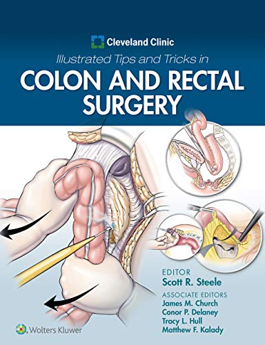 [PDF] Cleveland Clinic Illustrated Tips and Tricks in Colon and Rectal Surgery 1st Edition (2019) by Scott Steele