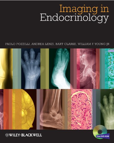 [PDF] Imaging in Endocrinology 1st Edition (2014) by Paolo Pozzilli