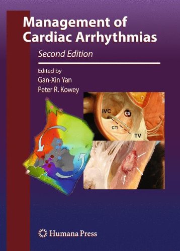 [PDF] Management of Cardiac Arrhythmias, 2nd Edition (2011) by Gan-Xin Yan