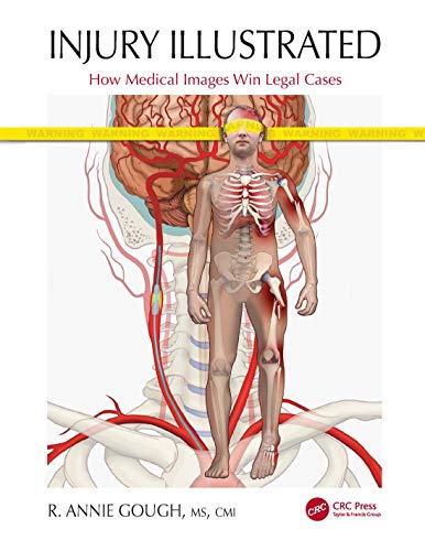 [PDF] Injury Illustrated: How Medical Images Win Legal Cases 1st Edition (2021) by R. Annie Gough