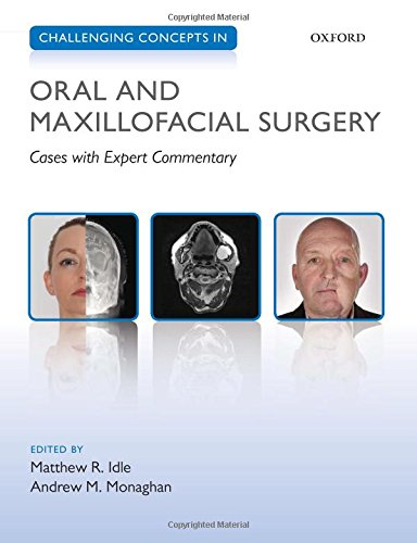 [PDF] Challenging Concepts in Oral and Maxillofacial Surgery Cases with Expert Commentary (2016) by Matthew Idle