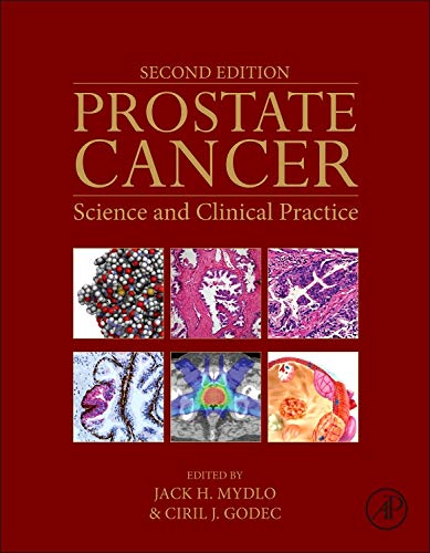 [PDF] Prostate Cancer: Science and Clinical Practice 2nd Edition (2015) by Jack H. Mydlo