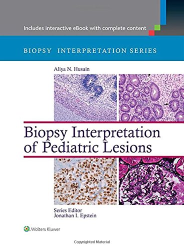 [PDF] Biopsy Interpretation of Pediatric Lesions (2014) by Aliya N. Husain MD