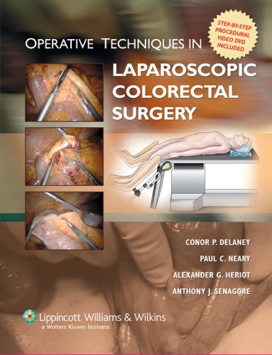 [CHM] Operative Techniques in Laparoscopic Colorectal Surgery (2007) by Conor P. Delaney