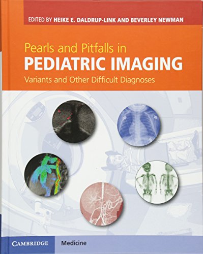 [PDF] Pearls and Pitfalls in Pediatric Imaging: Variants and Other Difficult Diagnoses 1st Edition (2014) by Heike E. Daldrup-Link