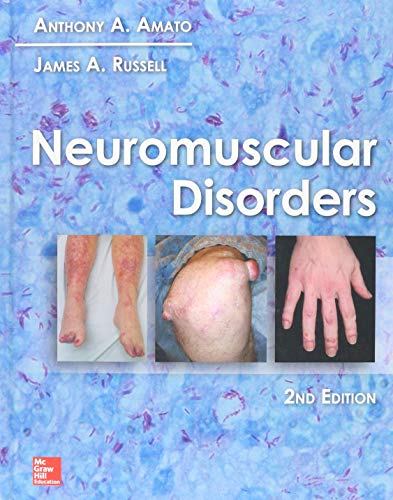 [PDF] Neuromuscular Disorders, 2nd Edition (2016) by Anthony A. Amato