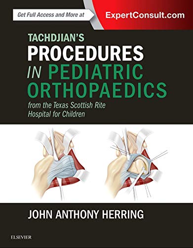 [PDF] Tachdjian’s Procedures in Pediatric Orthopaedics: From the Texas Scottish Rite Hospital for Children (2016) by John A. Herring