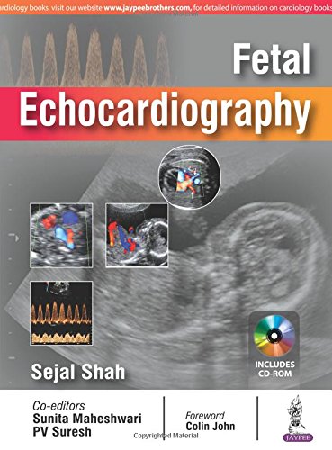 [PDF] Fetal Echocardiography 1st Edition (2017) by Sejal Shah