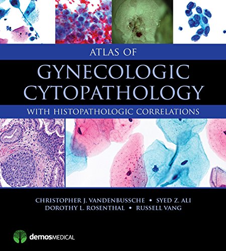 [PDF] Atlas of Gynecologic Cytopathology 1st Edition (2015) by Christopher J. VandenBussche MD PhD and Syed Z. Ali MD FRCPath FIAC