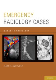 [PDF] Emergency Radiology Cases (2014) by Hani H. Abujudeh, MD, MBA, FSIR