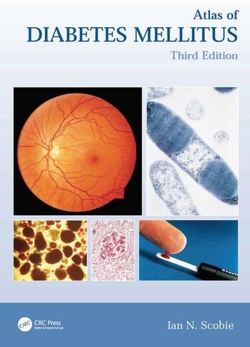 [PDF] Atlas of Diabetes Mellitus, Third Edition 3rd Edition (2006) by Ian N. Scobie