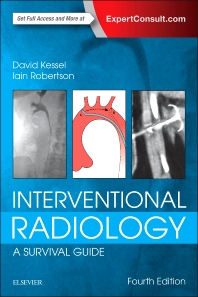 [PDF] Interventional Radiology: A Survival Guide 4th Edition (2017) by David Kessel Iain Robertson