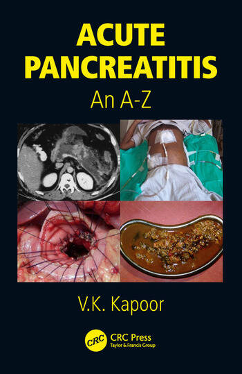 [PDF] Acute Pancreatitis An A-Z (2018) by V.K. Kapoor