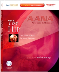 [PDF] AANA Advanced Arthroscopy The Hip (2010) by J.W. Byrd Carlos Guanche