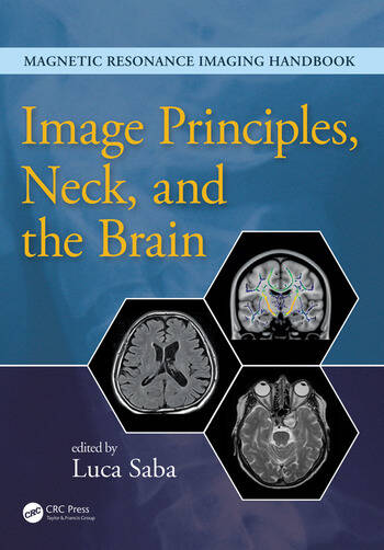 [PDF] Image Principles, Neck, and the Brain 1st Edition (2016) by Luca Saba