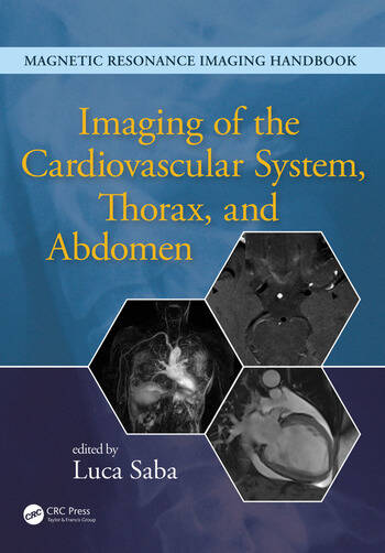 [PDF] Imaging of the Cardiovascular System, Thorax, and Abdomen (2017) by Luca Saba