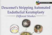 Descemet’s Stripping Automated Endothelial Keratoplasty Different Strokes 1st Edition (2013) by Dermot Cassidy PDF