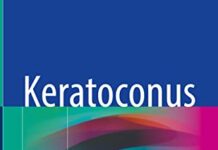 Keratoconus: A Comprehensive Guide to Diagnosis and Treatment (2022) by Edna Almodin PDF